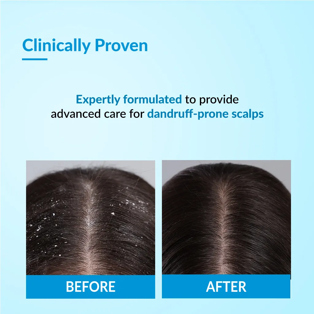 Bioteez Advance Shampoo - Image 3