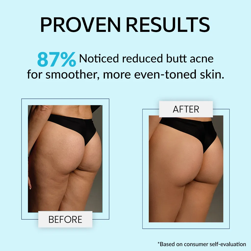 Teenilicious Bum Body Cream - Image 4