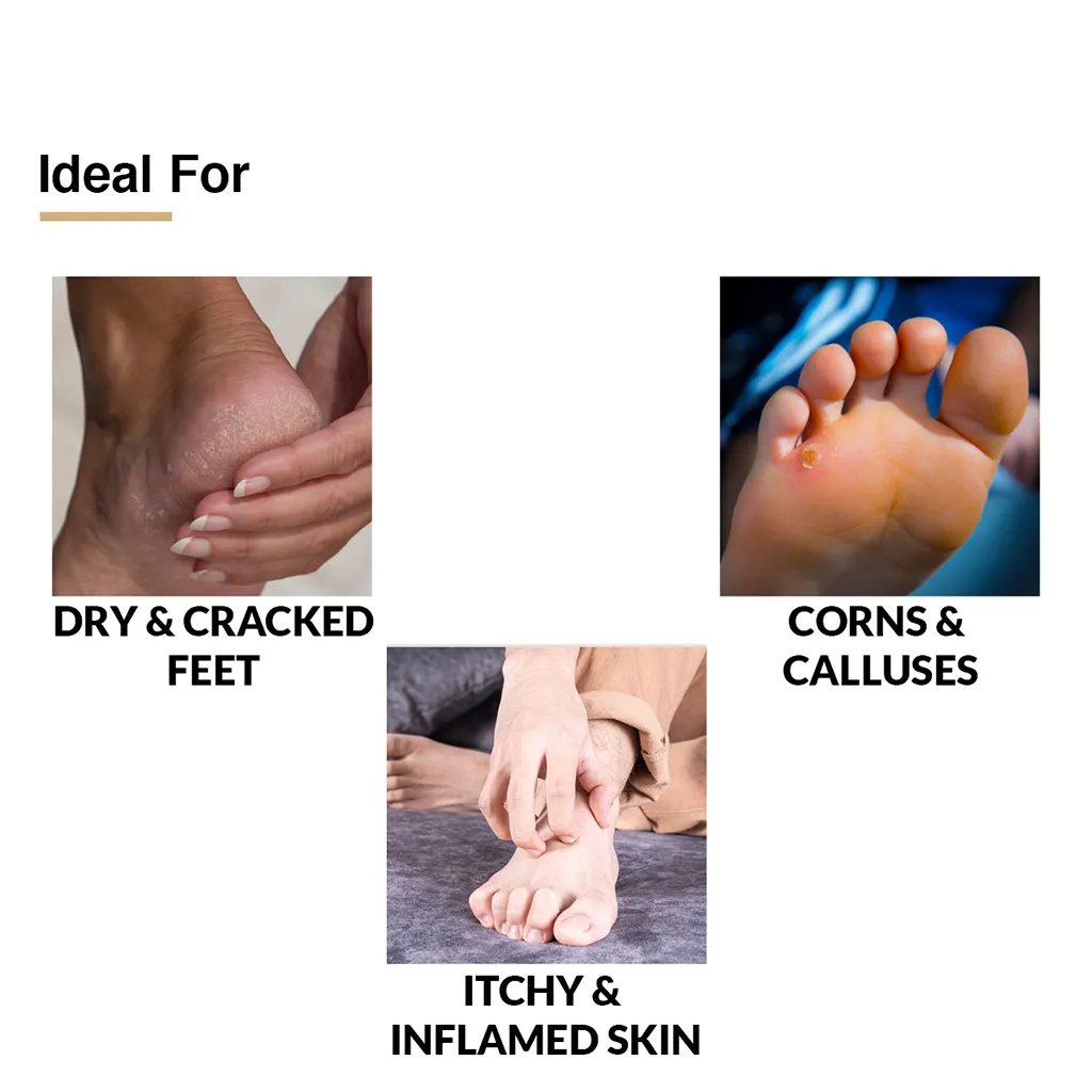 Foot Cream for Cracked Heels - Image 3