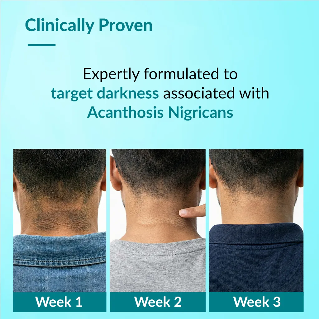 Nigrifix Advance Cream - Image 3