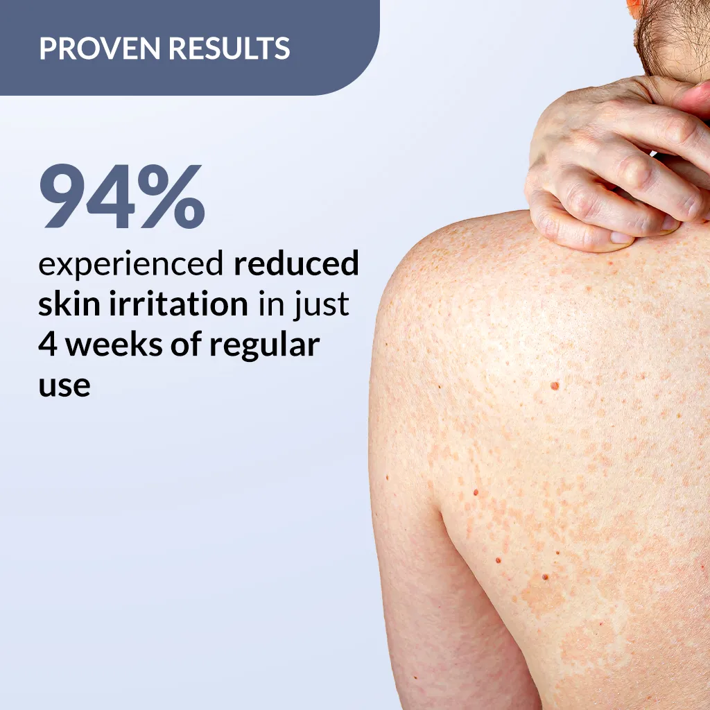 Salyzap Spray for Body Acne - Image 3