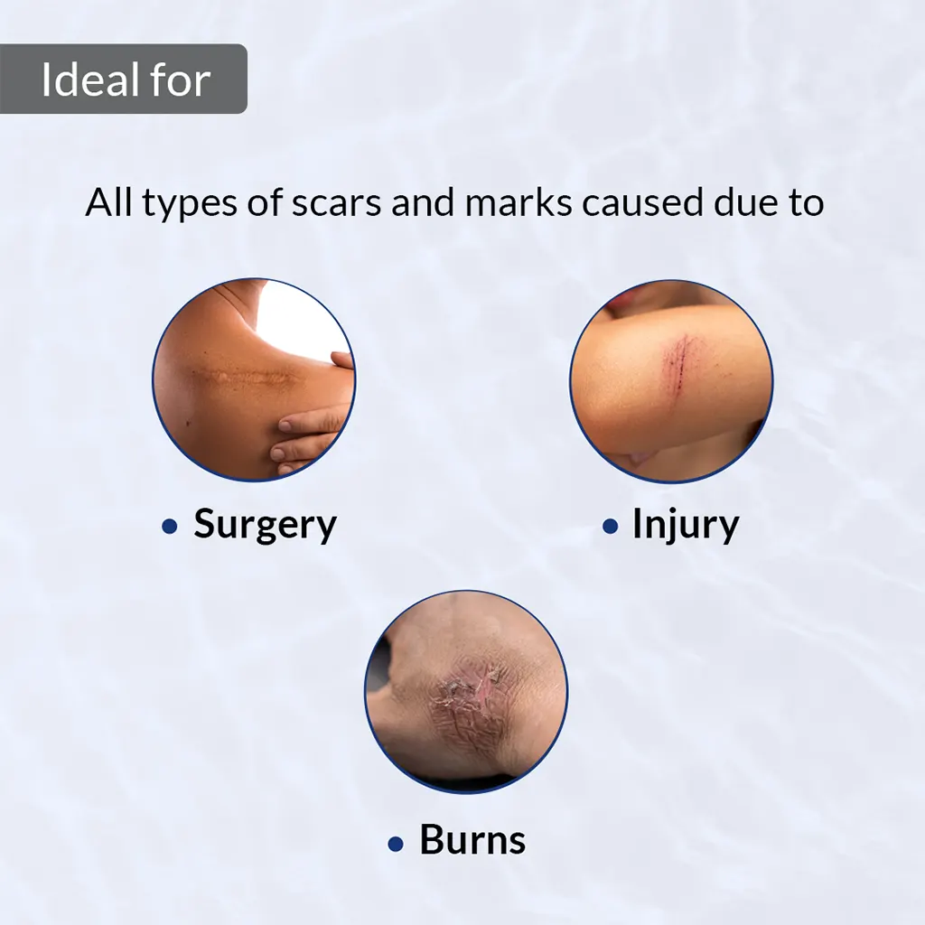 Scar Gel for Scars - Image 3