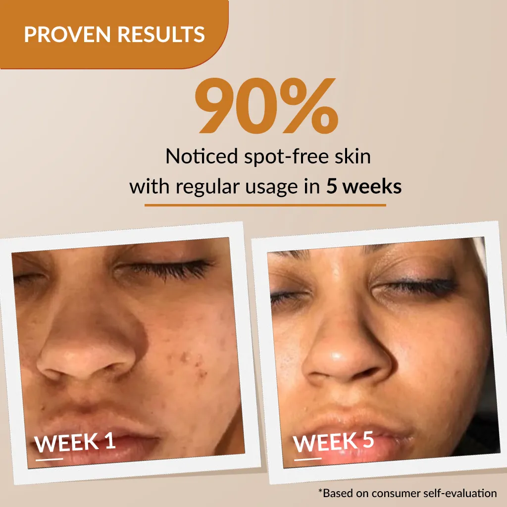 Skarfix-Plus Scar Removal Cream - Image 4